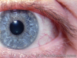 Auge (Farbe) Direktdruck