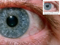 Auge (siehe Bild oben, kleines Auge in Bildmitte) in rund 18facher Vergrößerung.