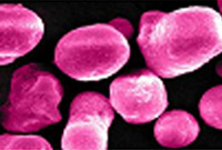 HP Color Laserjet CP4005 Tonerpartikel 1998