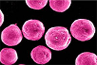 HP Color Laserjet CP4005 Tonerpartikel 2005