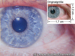 Auge (siehe Bild oben, kleines Auge in Bildmitte) in rund 18facher Vergrößerung.