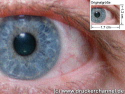 Auge (siehe Bild oben, kleines Auge in Bildmitte)in rund 18facher Vergrößerung.