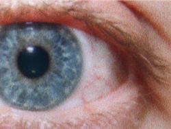 Auge (siehe oben, kleines Auge in Bildmitte) in rund 18facher Vergrößerung.