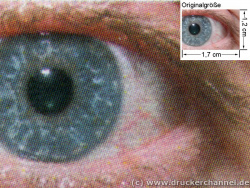 2450: Auge (siehe Bild oben, kleines Auge in Bildmitte) in rund 18facher Vergrößerung.