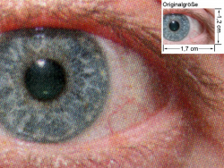 Farbdruck PS3: Auge (siehe Bild oben, kleines Auge in Bildmitte) in rund 18facher Vergrößerung.